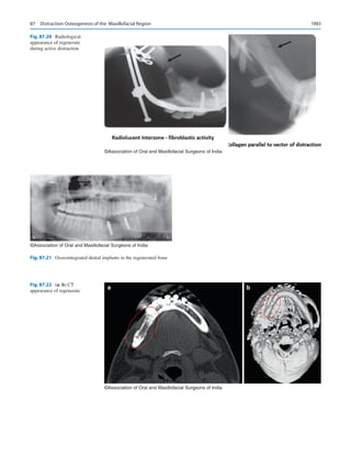 Publication- acknowledgement-AOMSI_Book- 1698.pdf