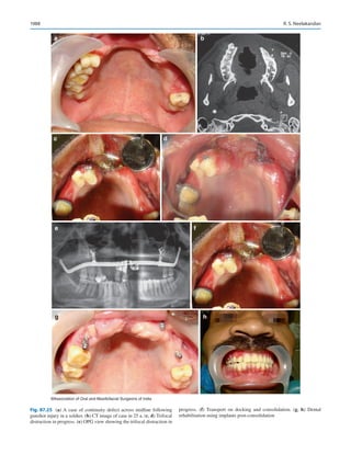 Publication- acknowledgement-AOMSI_Book- 1698.pdf