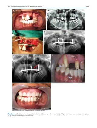 Publication- acknowledgement-AOMSI_Book- 1698.pdf