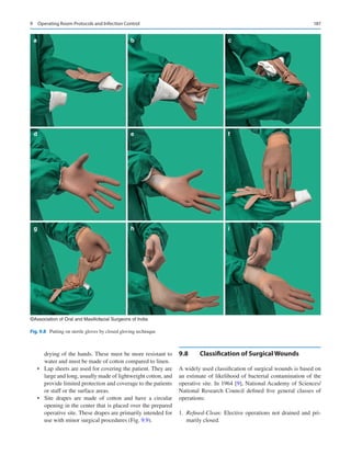 187
drying of the hands. These must be more resistant to
water and must be made of cotton compared to linen.
•	 Lap sheets are used for covering the patient. They are
large and long, usually made of lightweight cotton, and
provide limited protection and coverage to the patients
or staff or the surface areas.
•	 Site drapes are made of cotton and have a circular
opening in the center that is placed over the prepared
operative site. These drapes are primarily intended for
use with minor surgical procedures (Fig. 9.9).
9.8	 Classification of Surgical Wounds
A widely used classification of surgical wounds is based on
an estimate of likelihood of bacterial contamination of the
operative site. In 1964 [9], National Academy of Sciences/
National Research Council defined five general classes of
operations:
	1.	 Refined-Clean: Elective operations not drained and pri-
marily closed.
a b c
d e f
g h i
©Association of Oral and Maxillofacial Surgeons of India
Fig. 9.8  Putting on sterile gloves by closed gloving technique
9  Operating Room Protocols and Infection Control
 