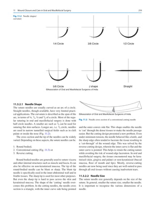 219
11.3.2.1	 Needle Shape
The suture needles are usually curved as an arc of a circle.
Straight needles, though available, have very limited practi-
cal applications. The curvature is described as the span of the
arc, in terms of ¼, 3
/8, ½ and 5
/8 of a circle. Most of the regu-
lar suturing in oral and maxillofacial surgery is done with
half circle needles. A smaller arc such as 3
/8 can be used for
suturing flat skin surfaces. Longer arc, i.e. 5
/8 circle, needles
are used in narrow tunnelled surgical fields such as in cleft
palate or inside the nose (Fig. 11.2).
The cross section and the tip of the needles can be widely
varied. Depending on these aspects, the suture needles can be.
	1.	 Round bodied,
	
2.	 Conventional cutting (Fig. 11.3) or
	3.	 Reverse cutting.
Round bodied needles are generally used to suture viscera
and other internal structures such as muscle and fascia. It can
also be effective on non-keratinised mucosa. The tip of the
round-bodied needle can be blunt or sharp. The blunt tip
needle is specifically used in the inner abdominal wall and in
friable tissues. The sharp tip is used for most other purposes.
But even the sharp tip is hard to pass across the skin and
keratinised mucosa. The shape of the ‘cutting’ needle over-
comes this problem. In the cutting needles, the needle cross
section is a triangle, with the inner curve side being pointed
and the outer convex side flat. This shape enables the needle
to ‘cut’ through the dense tissues to make the needle passage
easier. But the cutting design presented a new problem. Even
under minimum tension, the needle behaved like a knife, and
the sharp edge often tended to lacerate the tissue resulting in
a ‘cut-through’ of the wound edge. This was solved by the
reverse-cutting design, wherein the inner curve is flat and the
outer curve is pointed. This helps to retain the cutting nature
while avoiding the risk of wound edge laceration. In oral and
maxillofacial surgery, the tissues encountered may be kera-
tinised (skin, gingiva and palate) or non-keratinised (buccal
mucosa, floor of mouth and lips). Mostly, reverse-cutting
needles are now being used since they are well-suited to pass
through all oral tissues without causing inadvertent tears.
11.3.2.2	 Needle Size
The suture needle size generally depends on the size of the
suture. In general, smaller the suture size, smaller the needle.
It is important to recognise the various dimensions of a
needle.
©Association of Oral and Maxillofacial Surgeons of India
Fig. 11.2  Needle shapes/
curvature
©Association of Oral and Maxillofacial Surgeons of India
Fig. 11.3  Needle cross section of a conventional cutting needle
11  Wound Closure and Care in Oral and Maxillofacial Surgery
 