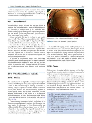 235
This technique ensures a better orientation of the sutures
with respect to the wound. The superficial, exposed parts of
the suture are oriented perpendicular to the wound, leading
to better anatomic wound approximation.
11.9	 Suture Removal
Non-absorbable sutures on skin and mucosa should be
removed after the wound surface has achieved initial stabil-
ity. The timing of suture removal is very important. They
should remain in tissue long enough to prevent dehiscence
and scar spread. On the other hand, early removal reduces
tissue reaction and suture marks.
Sutures on facial skin and in oral cavity are usually
removed in 5–7 days. The recommended interval is 3–5 days
for eyelids, 7 days for neck and 7–10 days for scalp. Those
on trunk and limbs should remain in place for 10–14 days.
The suture line is cleansed with antiseptic. The knot is
grasped and is pulled away mildly from the surface and to
one side of the wound. An uncontaminated segment of the
thread is exposed on the other side by this pull. The thread is
cut at this segment near to the surface. Then the suture is
pulled out, making sure that no contaminated (exposed) part
is ragged through the tissues.
In the case of a continuous suture, every single loop
should be cut and pulled out separately.A subcuticular suture
is removed by cutting the knot off at any one end, and then
pulling the suture out gently from the other end. It is impor-
tant to make sure that the suture does not break within the
tissues.
11.10	 
Other Wound Closure Methods
11.10.1  Staples
The use of specialised staples for wound closure was pop-
ularized in 1900s by the Hungarian surgeon Hümér Hültl,
known as the ‘father of surgical stapling’. Compared to
suturing, surgical stapling is a quicker method to close the
skin in large wounds, and the inflammatory response is
relatively less. Staples provide good wound edge eversion
without strangulation of the tissue. It is an excellent
method to employ in cases which require quick wound
closure and where aesthesis is not a major concern [10]
(Fig. 11.19).
Though titanium staples were initially used, almost all of
the contemporary hardware is stainless steel. However, tita-
nium retains the advantages of being biocompatible and
MRI-compatible. Bioresorbable staples, based on polygly-
colic acid, are also available. The stapler devise itself may be
of stainless steel (reusable) or plastic (disposable), into
which the disposable staple cartridges can be loaded.
In maxillofacial surgery, staples are frequently used to
close scalp wounds and neck incisions, following the closure
of internal layers with conventional sutures. Staples are also
popular in reconstructive surgery to secure skin grafts and to
close the flap donor sites. They are not generally used to
close facial wounds, since there is a tendency to produce
‘rail-road track’ scars. Skin staples are removed after 7-10
days with a specialized staple remover device.
11.10.2  Tapes
Different types of surgical adhesive tapes are used to effect
wound closure, to reduce tension on sutured wounds and to
reinforce wound site after suture removal.
The indications of this method for wound closure per se
are limited. Tapes can be used to close superficial lacerations
where tissue tension is minimal. They are also employed in
the closure of superficial layer after buried dermal sutures
have been employed for wound edge approximation and ten-
sion reduction. A major indication is its use an additional
reinforcement and protection over sutured wounds. The
advantages of using tapes for wound closure are.
(a)	 They are rapid and easy to perform.
(b)	The tape application is painless (patient anxiety
and discomfort are minimal).
(c)	 Residual suture track scars are avoided.
(d)	 There is no need for a review visit to remove the
tape.
(e)	 Tapes, being non-invasive, are less prone to infec-
tion than other methods.
(f)	They are suitable for thin, fragile skin of the
elderly and infants.
©Association of Oral and Maxillofacial Surgeons of India
Fig. 11.19  Stapled scalp incision in a coronal approach
11  Wound Closure and Care in Oral and Maxillofacial Surgery
 