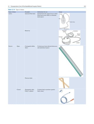 251
Table 12.14  Types of drains
Type of drain Example Indications for use Image
Active Jackson-Pratt drain Inserted into the surgical site to drain
blood and serous fluid; to eliminate
dead spaces
Stopper
Bulb
Flexible tubing
Drainage end
100
75
50
25
JACKSON PARTY
Hemovac Evacuator
tubing
Evacutor
Connector
Wound
tubing
Needle
Passive Open Corrugated rubber
drain
To drain pus from infected abscesses
and anatomical spaces
Penrose drain
Closed Nasogastric tube,
Foley’s catheter
To drain body secretions (gastric
fluid, urine)
12  Postoperative Care of the Maxillofacial Surgery Patient
 