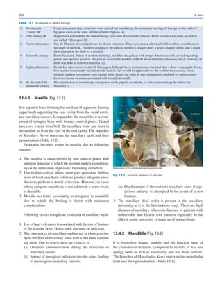 260
13.4.1  Maxilla (Fig. 13.1)
It is a paired bone forming the midface of a person, bearing
upper teeth separating the oral cavity from the nasal cavity
and maxillary sinuses. Compared to the mandible, it is com-
posed of spongier bone with thinner cortical plates. Palatal
processes extend from both the maxillary bone and meet in
the midline to form the roof of the oral cavity. The branches
of Maxillary Nerve innervate the maxillary teeth and their
periodontium (Table 13.2).
Exodontia becomes easier in maxilla due to following
reasons:
	
1.	The maxilla is characterized by thin cortical plates with
spongier bone due to which the alveolar sockets expand eas-
ily on the application of pressure, facilitating extraction.
	
2.	 Due to thin cortical plates, mere para periosteal infiltra-
tions of local anesthetic solutions produce adequate anes-
thesia to perform a dental extraction. However, in cases
where adequate anesthesia is not achieved, a nerve block
is desirable.
	
3.	 Maxilla has better vascularity as compared to mandible
due to which the healing is faster with minimum
complications.
Following factors complicate exodontia of maxillary teeth:
	1.	 Use of heavy elevators is associated with the risk of fracture
of the alveolar bone. Hence, their use must be judicious.
	
2.	 The root apices of maxillary molars are in close proxim-
ity to the floor of maxillary sinus with a thin bone separat-
ing them. Due to which there are chances of.
	 (a)	Oroantral communication during the extraction of
maxillary molars.
	 (b)	 Spread of periapical infection into the sinus leading
to odontogenic maxillary sinusitis.
	 (c)	 Displacement of the root into maxillary sinus if inju-
dicious retrieval is attempted in the event of a root
fracture.
	
3.	The maxillary third molar is present in the maxillary
tuberosity as it is the last tooth to erupt. There are high
chances of maxillary tuberosity fracture in patients with
unfavorable and bizarre root patterns especially in the
elderly as the tuberosity is made up of spongy bone.
13.4.2  Mandible (Fig. 13.2)
It is horseshoe shaped, mobile and the heaviest bone of
the craniofacial skeleton. Compared to maxilla, it has less
spongy bone as well as vascularity and has thick cortices.
The branches of Mandibular Nerve innervate the mandibular
teeth and their periodontium (Table 13.3).
Table 13.1  Evolution of dental forceps
1 Seventeenth
Century BC
It can be assumed that extractions were carried out considering the prominent carvings of forceps on the walls of
Egyptian caves in the work of Edwin Smith Papyrus [4].
2 Fifth century BC Hippocrates referred that the dental forceps have been discovered in Greece. These forceps were made up of Iron
and called ‘Odontagra’ [4].
3 Fourteenth century Guy de Chauliac invented pelicans for dental extraction. They were named after the bird from their resemblance to
the shape of the beak. The early drawing of the pelican showed a straight shaft, a wheel-shaped bolster, and a single
claw attached to the shaft by a rivet [2].
4 Sixteenth century Pierre Fauchard, ‘father of modern dentistry’, modified the pelican with proper dimensions and advised regarding
patient and operator position. His pelican was double hooked and held the tooth firmly, following which ‘shaking’ of
tooth was done to achieve extraction [5].
5 Eighteenth century Dental key (also known as clef de Garengeot, fothergill key), an instrument modeled after a door was popular. It was
first inserted horizontally into the mouth, then its claw would be tightened over the tooth to be extracted. Once
secured, rotation movements were carried out to loosen the tooth. It was continuously modified for better results;
however, its use was often associated with complications [2].
6 By the end of the
nineteenth century
The introduction of modern-day forceps was made popular notably by sir John tomes making the dental key
obsolete [2].
©Association of Oral and Maxillofacial Surgeons of India
Fig. 13.1  Alveolar process of maxilla
A. Jain
 