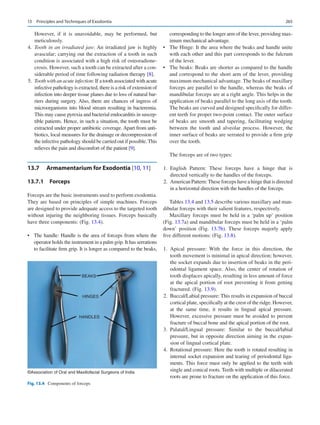 265
However, if it is unavoidable, may be performed, but
meticulously.
	4.	 Tooth in an irradiated jaw: An irradiated jaw is highly
avascular; carrying out the extraction of a tooth in such
condition is associated with a high risk of osteoradione-
crosis. However, such a tooth can be extracted after a con-
siderable period of time following radiation therapy [8].
	5.	 Tooth with an acute infection: If a tooth associated with acute
infective pathology is extracted, there is a risk of extension of
infection into deeper tissue planes due to loss of natural bar-
riers during surgery. Also, there are chances of ingress of
microorganisms into blood stream resulting in bacteremia.
This may cause pyrexia and bacterial endocarditis in suscep-
tible patients. Hence, in such a situation, the tooth must be
extracted under proper antibiotic coverage. Apart from anti-
biotics, local measures for the drainage or decompression of
the infective pathology should be carried out if possible. This
relieves the pain and discomfort of the patient [9].
13.7	 Armamentarium for Exodontia [10, 11]
13.7.1  Forceps
Forceps are the basic instruments used to perform exodontia.
They are based on principles of simple machines. Forceps
are designed to provide adequate access to the targeted tooth
without injuring the neighboring tissues. Forceps basically
have three components: (Fig. 13.4).
•	 The handle: Handle is the area of forceps from where the
operator holds the instrument in a palm grip. It has serrations
to facilitate firm grip. It is longer as compared to the beaks,
corresponding to the longer arm of the lever, providing max-
imum mechanical advantage.
•	 The Hinge: It the area where the beaks and handle unite
with each other and this part corresponds to the fulcrum
of the lever.
•	 The beaks: Beaks are shorter as compared to the handle
and correspond to the short arm of the lever, providing
maximum mechanical advantage. The beaks of maxillary
forceps are parallel to the handle, whereas the beaks of
mandibular forceps are at a right angle. This helps in the
application of beaks parallel to the long axis of the tooth.
The beaks are curved and designed specifically for differ-
ent teeth for proper two-point contact. The outer surface
of beaks are smooth and tapering, facilitating wedging
between the tooth and alveolar process. However, the
inner surface of beaks are serrated to provide a firm grip
over the tooth.
The forceps are of two types:
	
1.	English Pattern: These forceps have a hinge that is
directed vertically to the handles of the forceps.
	2.	 American Pattern:These forceps have a hinge that is directed
in a horizontal direction with the handles of the forceps.
Tables 13.4 and 13.5 describe various maxillary and man-
dibular forceps with their salient features, respectively.
Maxillary forceps must be held in a ‘palm up’ position
(Fig. 13.7a) and mandibular forceps must be held in a ‘palm
down’ position (Fig.  13.7b). These forceps majorly apply
five different motions: (Fig. 13.8).
	
1.	Apical pressure: With the force in this direction, the
tooth movement is minimal in apical direction; however,
the socket expands due to insertion of beaks in the peri-
odontal ligament space. Also, the center of rotation of
tooth displaces apically, resulting in less amount of force
at the apical portion of root preventing it from getting
fractured. (Fig. 13.9).
	2.	 Buccal/Labial pressure: This results in expansion of buccal
cortical plate, specifically at the crest of the ridge. However,
at the same time, it results in lingual apical pressure.
However, excessive pressure must be avoided to prevent
fracture of buccal bone and the apical portion of the root.
	
3.	Palatal/Lingual pressure: Similar to the buccal/labial
pressure, but in opposite direction aiming in the expan-
sion of lingual cortical plate.
	
4.	 Rotational pressure: Here the tooth is rotated resulting in
internal socket expansion and tearing of periodontal liga-
ments. This force must only be applied to the teeth with
single and conical roots. Teeth with multiple or dilacerated
roots are prone to fracture on the application of this force.
BEAKS
HINGES
HANDLES
©Association of Oral and Maxillofacial Surgeons of India
Fig. 13.4  Components of forceps
13  Principles and Techniques of Exodontia
 