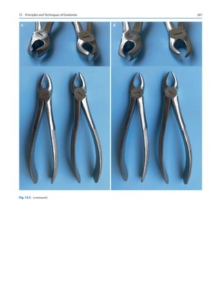 267
c d
d
Fig. 13.5 (continued)
13  Principles and Techniques of Exodontia
 