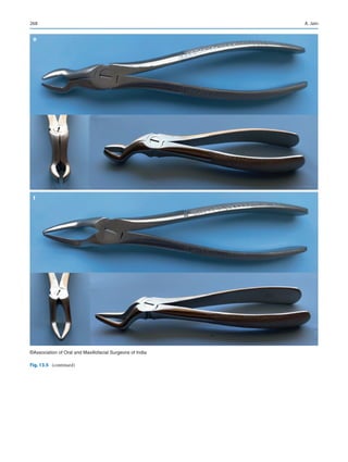268
e
f
©Association of Oral and Maxillofacial Surgeons of India
Fig. 13.5 (continued)
A. Jain
 