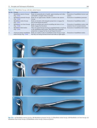 269
Fig. 13.6 (a) Mandibular anterior forceps, (b) Mandibular premolar forceps, (c) Mandibular molar forceps, (d) Mandibular cow horn forceps, (e)
Mandibular third molar forceps, (f) Mandibular molar forceps (American pattern)
a
b
c
d
Table 13.5  Mandibular forceps with their salient features
Sr. No. Forceps Description Use
1 Mandibular anterior forceps
(Fig. 13.6a)
Beaks are perpendicular to handle, approximating each other,
and handle is straight with no curvature
Extraction of mandibular incisors and
canines
2 Mandibular premolar forceps
(Fig. 13.6b)
Beaks do not approximate. Handle is similar to the anterior
forceps
Extraction of mandibular premolars
3 Mandibular molar forceps
(Fig. 13.6c)
Beaks are broader with triangular projections to engage the
buccal and lingual furcations
Extraction of mandibular molars
4 Mandibular cow horn forceps
(Fig. 13.6d)
Beaks are pointed and conical resembling the horns of cow.
Beaks engage the furcations
Extraction of mandibular molars with
extensive loss of coronal structure
5 Mandibular third molars
(Fig. 13.6e)
These are paired forceps having an angulated beak to reach up
to the mandibular third molars. Both beaks have triangular
projections to engage the buccal and lingual furcation
Extraction of mandibular third molars
6 American pattern mandibular
molar forceps (Fig. 13.6f)
Beaks are similar to that of mandibular molar forceps except
that they are facing forward toward each other at right angles
Extraction of mandibular molars
13  Principles and Techniques of Exodontia
 