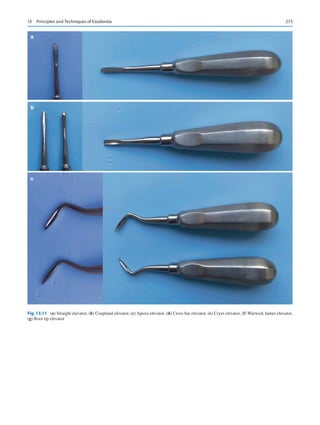 273
Fig. 13.11 (a) Straight elevator, (b) Coupland elevator, (c) Apexo elevator, (d) Cross bar elevator, (e) Cryer elevator, (f) Warwick James elevator,
(g) Root tip elevator
a
b
c
13  Principles and Techniques of Exodontia
 