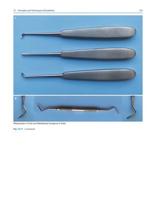 275
f
g
©Association of Oral and Maxillofacial Surgeons of India
Fig. 13.11 (continued)
13  Principles and Techniques of Exodontia
 