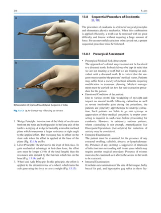 276
	
1.	 Wedge Principle: Introduction of the blade of an elevator
between the bone and tooth parallel to the long axis of the
tooth is wedging.A wedge is basically a movable inclined
plane which overcomes a larger resistance at right angle
to the applied effort. The resistance has its effect on the
slant side when the effort is applied at the base of the
plane (Fig. 13.13a and b).
	2.	 Lever Principle: The elevator is the lever of first class. To
gain mechanical advantage in first-class lever, the effort
arm must be longer (3/4th of the total length) than the
resistance arm divided by the fulcrum which lies on the
bone (Fig. 13.14a and b).
	
3.	 Wheel and Axle Principle: In this principle, the effort is
applied to the circumference of a wheel, which turns the
axle generating the force to raise a weight (Fig. 13.15).
13.8	 
Sequential Procedure of Exodontia
[6, 10]
The procedure of exodontia is a blend of surgical principles
and elementary physics mechanics. When this combination
is applied efficiently, a tooth can be removed with no great
difficulty and finesse without requiring a large amount of
force. For an uneventful extraction to be carried out, a proper
sequential procedure must be followed.
13.8.1  Presurgical Assessment
•	 Presurgical Medical Risk Assessment:
The approach of a dental surgeon must not be localized
to a diseased tooth. It should always be kept in mind that
we are not treating a tooth but we are treating an indi-
vidual with a diseased tooth. It is critical that the sur-
geon must examine the patients’ medical status. Patients
may suffer from a variety of medical ailments requiring
modification in treatment planning. Medical manage-
ment must be carried out first for safe extraction proce-
dure for the patient.
•	 Emotional Condition of the patient:
Due to various myths like weakening of eyesight and
impact on mental health following extraction as well
as severe intolerable pain during the procedure, the
patients are generally apprehensive to undergo extrac-
tion. Such patients are liable to go into syncope or
aggravation of their medical condition. A proper coun-
seling is required in such cases before proceeding for
exodontia. However, in extremely anxious patients,
where counseling is not enough, premedication like
Diazepam/Alprazolam (Anxiolytics) for reduction of
anxiety may be considered.
•	 Extraoral Examination:
The patient must be examined for the presence of any
extraoral swelling, cellulitis, abscess, or lymphadenopa-
thy. Presence of any swelling is suggestive of extension
of infection into surrounding soft tissue space which may
require another surgical procedure. Presence of trismus
must also be examined as it affects the access to the tooth
to be extracted.
•	 Intraoral Examination:
It includes an examination of the size of the tongue, bulky
buccal fat pad, and hyperactive gag reflex as these fac-
©Association of Oral and Maxillofacial Surgeons of India
a
b
Fig. 13.12 (a, b) Correct way of holding an elevator
A. Jain
 