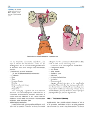 278
tors may hamper the access to the surgical site. Acute
signs of infection like inflammation, edema, and pus
discharge must also be assessed and the procedure must
be ­
performed under local antiseptic care and antibiotic
coverage.
•	 Examination of the tooth in question.
This step includes a thorough examination of
–
– Crown size
–
– Form
–
– Shape
–
– Presence of caries
–
– Mobility
–
– Previous endodontic therapy
–
– Tooth Angulation
–
– Malposition
These factors play a significant role in the extraction
procedure. The status of the adjacent tooth should also be
examined as in its absence the interdental bone cannot be
used as a fulcrum. Moreover, if it is carious, there are
chances of fracture of the adjacent tooth while application
of elevator in the interdental space.
•	 Radiographic Examination.
It is advisable to take a proper radiograph for any tooth
which is to be extracted. Generally, an intraoral periapical
radiograph provides accurate and sufficient details of the
tooth, its root/s, and the surrounding tissue.
Examination of the following factors must be done:
–
– Configuration of roots
–
– Size of roots
–
– Shape of roots
–
– Number of roots
–
– Root form
–
– Presence of dilacerations
–
– Resorption
–
– Hypercementosis
A proper radiograph also gives an idea regarding the
proximity of the root to the vital structures such as infe-
rior alveolar neurovascular bundle and maxillary sinus.
Moreover, the condition of surrounding bone can also be
identified for the presence of sclerotic bone or periapical
pathologies like cyst, abscess, or granuloma.
13.8.2  Treatment Planning
As the proverb says ‘Failing to plan is planning to fail’, it
is of paramount importance to device a proper treatment
plan before carrying out an extraction procedure. The degree
©Association of Oral and Maxillofacial Surgeons of India
Fig. 13.15  The elevator
acting on the principle of
Wheel and Axle aids in
retrieval of root from the
socket
A. Jain
 