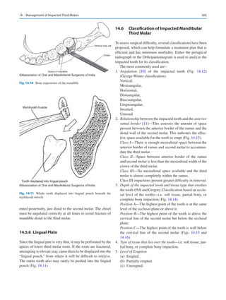 305
ented posteriorly, just distal to the second molar. The chisel
must be angulated correctly at all times to avoid fracture of
mandible distal to the third molar.
14.5.6	 Lingual Plate
Since the lingual pate is very thin, it may be perforated by the
apices of lower third molar roots. If the roots are fractured,
attempting to elevate may cause them to be displaced into the
“lingual pouch,” from where it will be difficult to retrieve.
The entire tooth also may rarely be pushed into the lingual
pouch (Fig. 14.11).
14.6	 Classification of Impacted Mandibular
Third Molar
To assess surgical difficulty, several classifications have been
proposed, which can help formulate a treatment plan that is
efficient and has minimum morbidity. Either the periapical
radiograph or the Orthopantomogram is used to analyze the
impacted tooth for its classification.
The most commonly used are:-
	1.	 Angulation [10] of the impacted tooth (Fig.  14.12)
(George Winter classification).
Vertical,
Mesioangular,
Horizontal,
Distoangular,
Buccoangular,
Linguoangular,
Inverted,
Unusual
	2.	 Relationship between the impacted tooth and the anterior
ramal border [11]—This assesses the amount of space
present between the anterior border of the ramus and the
distal wall of the second molar. This indicates the effec-
tive space available for the tooth to erupt (Fig. 14.13).
Class I—There is enough mesiodistal space between the
anterior border of ramus and second molar to accommo-
date the third molar.
Class II—Space between anterior border of the ramus
and second molar is less than the mesiodistal width of the
crown of the third molar.
Class III—No mesiodistal space available and the third
molar is almost completely within the ramus.
Class III impactions present greater difficulty in removal.
	3.	 Depth of the impacted tooth and tissue type that overlies
the tooth (Pell and Gregory Classification based on occlu-
sal level of the tooth)—i.e. soft tissue, partial bony, or
complete bony impaction (Fig. 14.14).
Position A—The highest point of the tooth is at the same
level of the occlusal plane or above it.
Position B—The highest point of the tooth is above the
cervical line of the second molar but below the occlusal
plane.
Position C—The highest point of the tooth is well below
the cervical line of the second molar (Figs.  14.15 and
14.16).
	4.	 Type of tissue that lies over the tooth—i.e. soft tissue, par-
tial bony, or complete bony impaction.
	5.	 Level of Eruption
	 (a)	Erupted.
	 (b)	 Partially erupted.
	 (c)	Unerupted.
©Association of Oral and Maxillofacial Surgeons of India
Fig. 14.10  Bone trajectories of the mandible
©Association of Oral and Maxillofacial Surgeons of India
Fig. 14.11  Whole tooth displaced into lingual pouch beneath the
mylohyoid muscle
14  Management of Impacted Third Molars
 