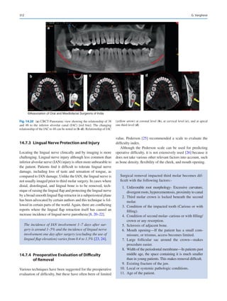 312
14.7.3	 
Lingual Nerve Protection and Injury
Locating the lingual nerve clinically and by imaging is more
challenging. Lingual nerve injury although less common than
inferior alveolar nerve (IAN) injury is often more unbearable to
the patient. Patients find it difficult to tolerate lingual nerve
damage, including loss of taste and sensation of tongue, as
compared to IAN damage. Unlike the IAN, the lingual nerve is
not usually imaged prior to third molar surgery. In cases where
distal, distolingual, and lingual bone is to be removed, tech-
nique of raising the lingual flap and protecting the lingual nerve
by a broad smooth lingual flap retractor in a subperiosteal plane
has been advocated by certain authors and this technique is fol-
lowed in certain parts of the world. Again, there are conflicting
reports where the lingual flap retraction itself has caused an
increase incidence of lingual nerve paresthesia [8, 20–22].
14.7.4	 
Preoperative Evaluation of Difficulty
of Removal
Various techniques have been suggested for the preoperative
evaluation of difficulty, but these have often been of limited
value. Pederson [25] recommended a scale to evaluate the
difficulty index.
Although the Pederson scale can be used for predicting
operative difficulty, it is not extensively used [26] because it
does not take various other relevant factors into account, such
as bone density, flexibility of the cheek, and mouth opening.
The incidence of IAN involvement 1–7 days after sur-
gery is around 1–5% and the incidence of lingual nerve
involvement one day after surgery (excluding the use of
lingual flap elevation) varies from 0.4 to 1.5% [23, 24].
Surgical removal impacted third molar becomes dif-
ficult with the following factors:-
	
1.	Unfavorable root morphology- Excessive curvature,
divergent roots, hypercementosis, proximity to canal
	
2.	Third molar crown is locked beneath the second
molar.
	
3.	Condition of the impacted tooth (Carious or with
filling).
	
4.	 Condition of second molar- carious or with filling/
crown or any resorption.
	
5.	 Sclerosis of adjacent bone.
	
6.	Mouth opening—If the patient has a small com-
missure, or trismus, access becomes limited.
	
7.	Large follicular sac around the crown—makes
procedure easier.
	
8.	 Width of the periodontal membrane—In patients past
middle age, the space containing it is much smaller
than in young patients. This makes removal difficult.
	
9.	 Existing fracture of the jaw.
	
10.	 Local or systemic pathologic conditions.
	
11.	 Age of the patient.
a
b c d
©Association of Oral and Maxillofacial Surgeons of India
Fig. 14.20 (a) CBCT Panoramic view showing the relationship of 38
and 48 to the inferior alveolar canal (IAC) [red line]. The changing
relationship of the IAC to 48 can be noted in (b–d). Relationship of IAC
(yellow arrow) at coronal level (b), at cervical level (c), and at apical
one third level (d)
G. Varghese
 