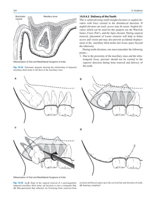 Publication- acknowledgement-AOMSI_Book- 1698.pdf