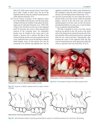 Publication- acknowledgement-AOMSI_Book- 1698.pdf