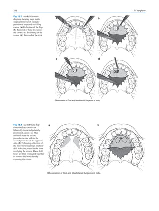 Publication- acknowledgement-AOMSI_Book- 1698.pdf