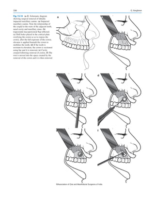 Publication- acknowledgement-AOMSI_Book- 1698.pdf