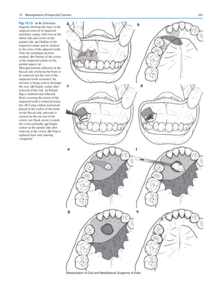 Publication- acknowledgement-AOMSI_Book- 1698.pdf