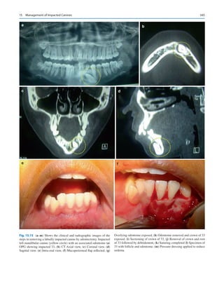 Publication- acknowledgement-AOMSI_Book- 1698.pdf