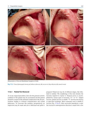 Publication- acknowledgement-AOMSI_Book- 1698.pdf
