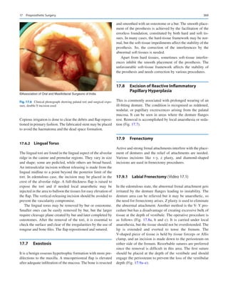 Publication- acknowledgement-AOMSI_Book- 1698.pdf