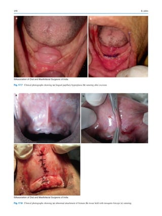 Publication- acknowledgement-AOMSI_Book- 1698.pdf