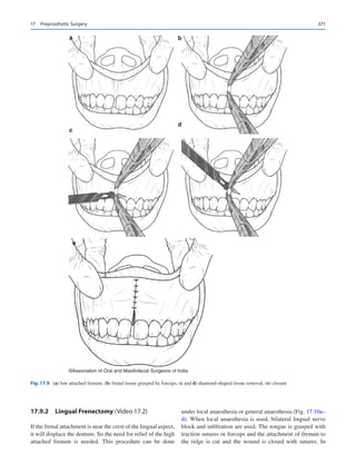 Publication- acknowledgement-AOMSI_Book- 1698.pdf