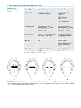 17
Physical Signs
Look externally
Evaluate 3-3-2 rule
Mallampatti scale
Obstruction
Neck mobility
Less difficult airway
Normalface and neck
No face or neck pathology
Abnormally face shape
Sunken cheeks
Edentulous
Buck teeth
Receding mandible
Narrow mouth
Obesity
Face or neck pathology
Mouth opening  3 fingers
Hyoid-chin distance  3 fingers
Thyroid cartilage to mouth
floor distance  2 fingers
Class III and IV (Can only see
the hard palate ± soft palate ±
base of uvula)
Pathology within or
surrounding the upper airway
(e.g., peritonsillar adscess,
epiglottis, retropharyngeal
abscess)
Limited range of motion of the
neck
More difficult airway
Mouth opening 3 fingers
Hyoid-chin distance  3 fingers
Thyroid cartilage to mouth floor
distance 2 fingers
Class I and II (Can see the soft palate,
uvula, fauces, ± facial pillars)
None
Can flex and extend the neck
normally
©Association of Oral and Maxillofacial Surgeons of India
Fig. 2.2 LEMON
Assessment for difficult
intubation
Fig. 2.3  Mallampati Classification for assessment for intubation. Class I: Cmplete visualization of the soft palate. No additional difficulty.
Class II: Complete visualizatin of the uvula. No additional difficulty. Class III: Visualization f only the base of the uvula. Moderate difficulty.
Class  IV: Soft palate is not visible at all. Severe difficulty
2  Preoperative Evaluation and Investigations for Maxillofacial Surgery
 