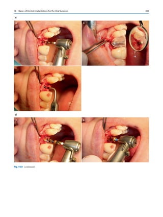 Publication- acknowledgement-AOMSI_Book- 1698.pdf