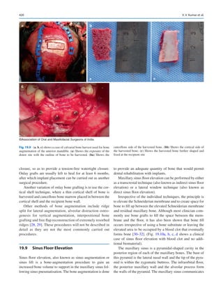Publication- acknowledgement-AOMSI_Book- 1698.pdf
