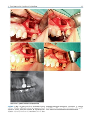 Publication- acknowledgement-AOMSI_Book- 1698.pdf