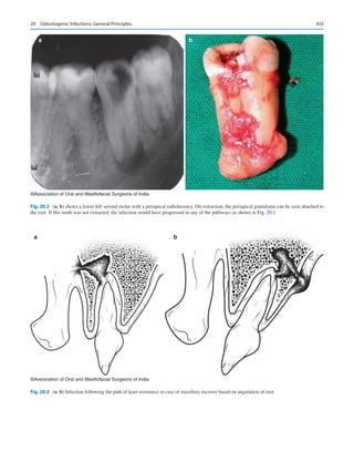 Publication- acknowledgement-AOMSI_Book- 1698.pdf