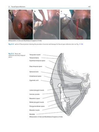 Publication- acknowledgement-AOMSI_Book- 1698.pdf