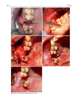 Publication- acknowledgement-AOMSI_Book- 1698.pdf