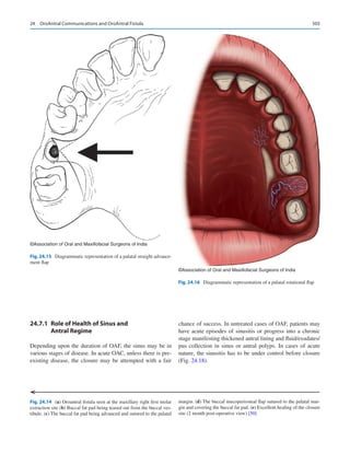Publication- acknowledgement-AOMSI_Book- 1698.pdf