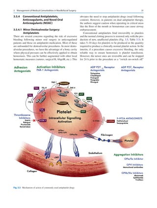 31
3.5.4	 Conventional Antiplatelets,
Anticoagulants, and Novel Oral
Anticoagulants (NOAC)
3.5.4.1  
Minor Dentoalveolar Surgery:
Antiplatelets
There are several concerns regarding the risk of excessive
bleeding following minor oral surgery in anticoagulated
patients and those on antiplatelet medication. Most of these
are unfounded for dentoalveolar procedures. In most dento-
alveolar procedures, we have the advantage of a bony cavity
where physical pressure can be effectively applied to obtain
hemostasis. This can be further augmented with other local
hemostatic measures (sutures, surgical R, AbgelR, etc.). This
obviates the need to stop antiplatelet drugs (read following
content). However, in patients on dual antiplatelet therapy,
the authors suggest caution when operating in critical areas
like the floor of the mouth as hematomas can cause airway
embarrassment.
Conventional antiplatelets bind irreversibly to platelets
and the normal clotting process is restored only with the pro-
duction of new, unaffected platelets (Fig. 3.5, Table 3.3). It
takes 5–10 days for platelets to be produced in the quantity
required to produce a clinically normal platelet action. In the
interim, if a procedure causes excessive bleeding, the only
reliable way to ensure hemostasis is platelet transfusion.
However, the newer ones are reversible and can be stopped
for 24 h prior to the procedure as a “switch on-switch off”
Fig. 3.5  Mechanism of action of commonly used antiplatelet drugs
3  Management of Medical Comorbidities in Maxillofacial Surgery
 