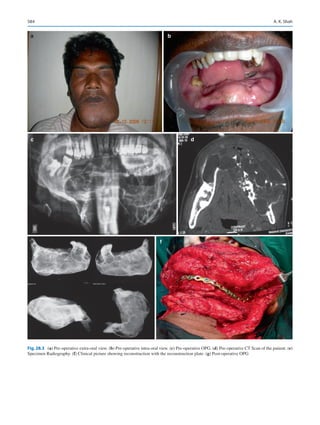 Publication- acknowledgement-AOMSI_Book- 1698.pdf