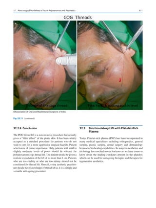 Publication- acknowledgement-AOMSI_Book- 1698.pdf