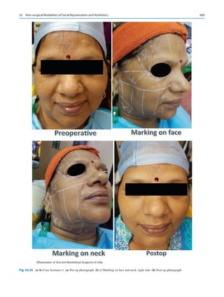 Publication- acknowledgement-AOMSI_Book- 1698.pdf