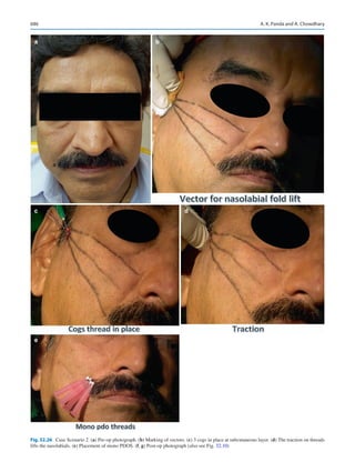 Publication- acknowledgement-AOMSI_Book- 1698.pdf