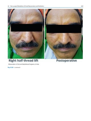 Publication- acknowledgement-AOMSI_Book- 1698.pdf