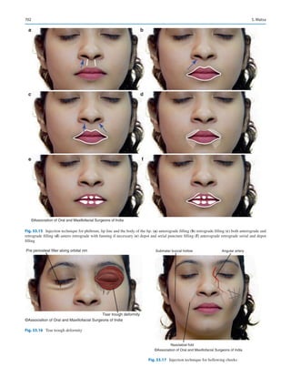 Publication- acknowledgement-AOMSI_Book- 1698.pdf