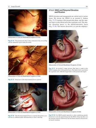 Publication- acknowledgement-AOMSI_Book- 1698.pdf