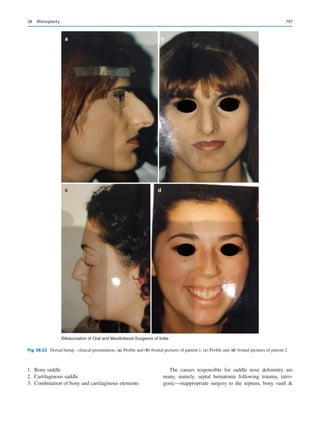 Publication- acknowledgement-AOMSI_Book- 1698.pdf