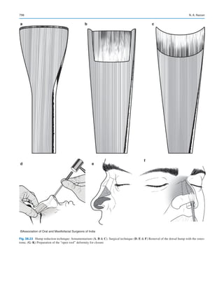Publication- acknowledgement-AOMSI_Book- 1698.pdf