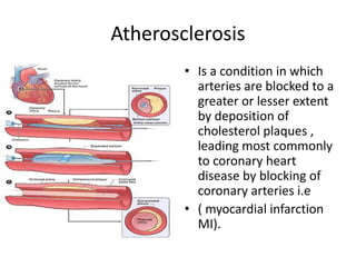 Atherosclerosis
• Is a condition in which
arteries are blocked to a
greater or lesser extent
by deposition of
cholesterol plaques ,
leading most commonly
to coronary heart
disease by blocking of
coronary arteries i.e
• ( myocardial infarction
MI).
 