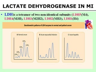 LACTATE DEHYDROGENASE IN MI
 
