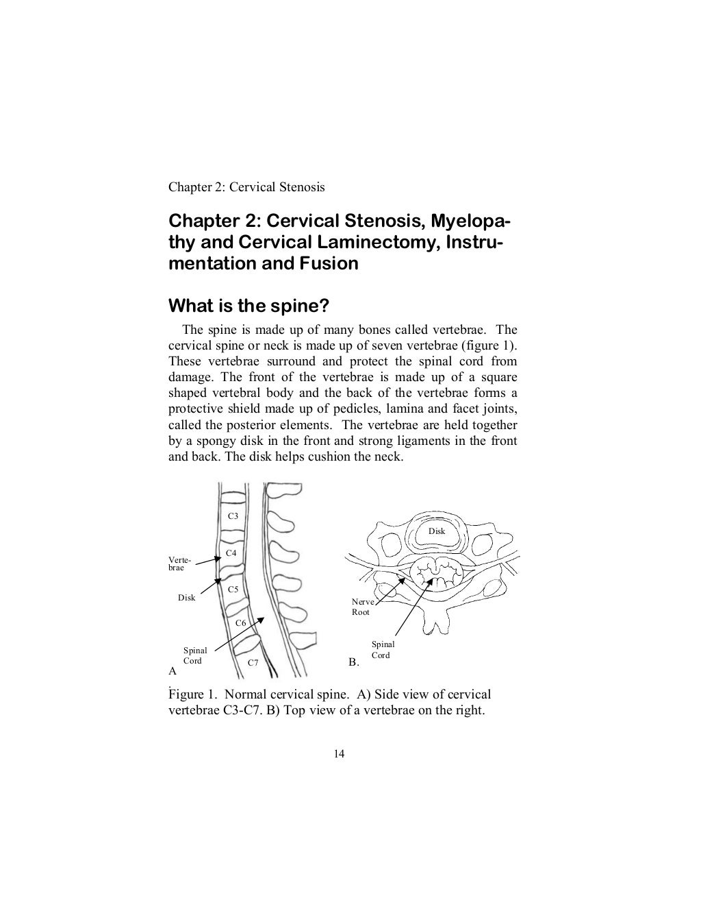 Spine Surgery in New York