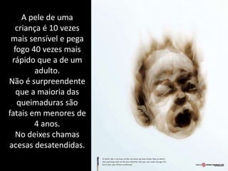 A pele de uma
   criança é 10 vezes
 mais sensível e pega
  fogo 40 vezes mais
 rápido que a de um
         adulto.
Não é surpreendente
   que a maioria das
   queimaduras são
fatais em menores de
        4 anos.
   No deixes chamas
acesas desatendidas.
 